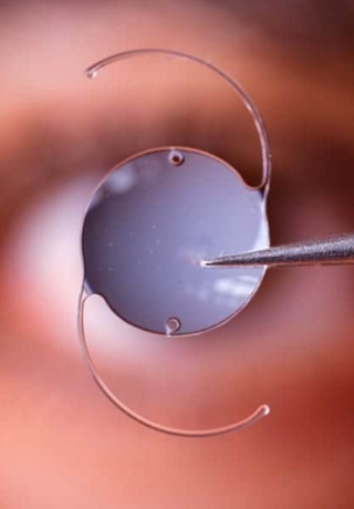 implant multifocal